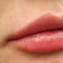 누브의원 이미지