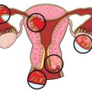로즈벨여성의원 이미지