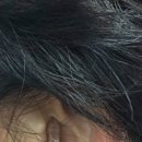 울림숲난청연구소 보청기 네이버블로그