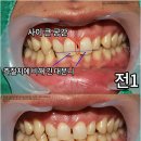 채움치과기공소 이미지