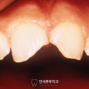연세부부치과 네이버블로그