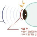 눈편한안경콘택트 이미지