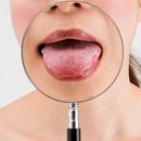 ‘혀’로 보는 건강상태 9가지 이미지