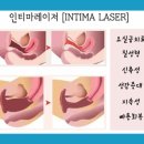 이쁜이PC 이미지