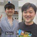 길메디텍 | 동해 남자 피부관리, 40대 남편 턱선 찾아준 김서이 피부연구소 (노필터 리얼 후기)