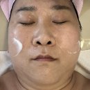 올가드림뷰티 성남신흥점 | 성남피부관리 제대로 받고 온 날, 올가드림뷰티 성남신흥점 모공디톡스 후기