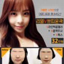 ★강남역★윤곽주사 얼굴전체부위1+1 8만원 10cc용량up !!/쁘띠윤곽 V라인턱끝필러+V윤곽주사+V톡스=32만원/신개념 히알라인필러★ 이미지