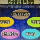 Re:만성골반통 여성 30~40%, 알고 보니 골반울혈증후군 이미지