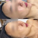 소삼로 | [부천피부관리] 올가드림뷰티 소사본동점 속건조 탈출 물광 케어 후기