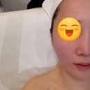 울산남구피부샵 디어벨르 맞춤 피부관리 받고온 후기