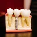 한숲치과의원 이미지