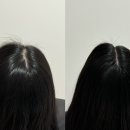 스칼프디자인센터 홍대점 이미지