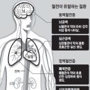 미세먼지가 위험한 진짜 이유 이미지