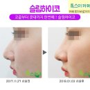 톡스미의원 이미지