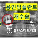 엄지치과기공소 네이버블로그