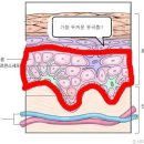 우리피부 이미지