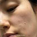 새한디플러스 | 기미 흑자 검버섯 모공 앰플 인포디플러스 세럼 후기
