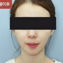 BF라인치과 네이버블로그