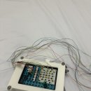 다원병원 | 아산병원-수면다원검사&amp;편도 아데노이드 절제술 후기