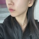 멍꿀개꿀 | [내돈내산 부산 피부과 추천] 팔자주름엔 쥬베룩 볼륨! 대구 경산에서 부산 서면까지 간 이유