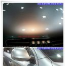 덴트렉스 이미지