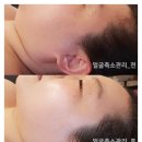 힐링스포&스파 이미지