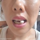(주)티오티컴퍼니 | 동국그룹 잇니플러스ㆍ 잇니플러스키즈 구강건강관리