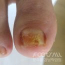 풋스올강남