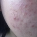 코디케어 이미지