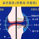 의정부 모커리한방병원 | 😱 출산보다 아픈 관절 통증?! 방치하면 큰일 나는 이유!