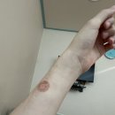 정직유부 정관점 | 정관 아이앤젤 제왕절개 3일차 후기 수액제거 수술부위소독 모유수유