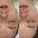 안양 범계 피부관리 맛집 엘가비에스테틱에서 기미색소관리 받은 솔직 후기