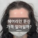 엠자탈모 탈출! 이마 필러 효과 얻는 방법! 부산헤어라인 부산두피문신 이미지