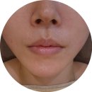 제이(J)에스테틱 | 구리신부관리 깐달걀 라인 리프팅 후기 닥터제이에스테틱