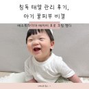 에스트라더마 베이비 프로 크림 엠디 보험적용 후기, 침독 태열 아기 꿀피부만들기