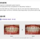자연미치과의원 네이버블로그