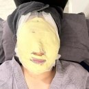 강남 제이앤 성형외과 피부과 콰트로리프팅 트리니티 주사