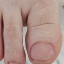 뷰티엔비(NB)성주점 | 확실한 문제성 발톱관리는 예산발관리전문 뷰티NB 성주점