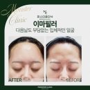 몬스터의원 네이버블로그