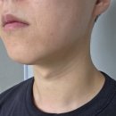 신논현약국 | 온다리프팅키닥터 | 신논현역 피부과 '앤퍼센트의원' 방문기