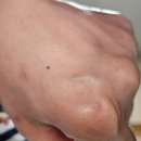 (주)우리약품 | 기미크림 추천, 약국템 닥터 프리메틱 기미 미백 크림으로 홈케어 솔직후기