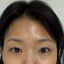 부평 이지브로우&왁싱 | 부평왁싱 < 디알스킨 > 눈썹 디자인 왁싱 후기