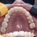 여치과기공소 이미지