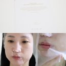 마린화장품 | 마스크팩 추천 키리아 테라피 순도 99% PDRN 마린 콜라겐 팩 후기