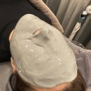 골드 | 송파나루역 피부과 좁쌀여드름 골드PTT 후기 (효과, 아픔정도)