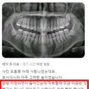 향동포레요양병원 | 용인사랑니치과, 사랑니 통증을 최소화하는 결정적 기준 2가지