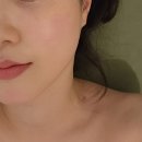 이예령 에스테틱 | [이예령에스테틱 송도] 리프팅탄력관리로 피부 컨디션 회복한 날