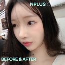 짧은코성형후기 다양한 라인으로