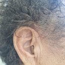 다비치히어링용인 - 용인시 수지구 현암로 102 | 다비치 보청기 용인사거리점이 추천하는 '렉스톤' 착용 후기