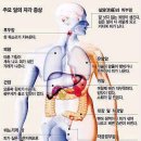 몸이 말하는 위험신호 34가지 이미지